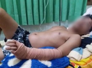 Youth from Purwoharjo Allegedly Becomes Victim of Beatings at Karaoke Venue